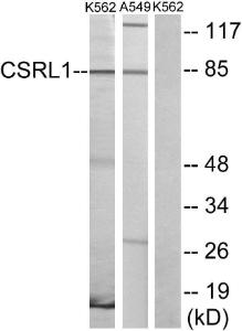 Western blot analysis of lysates from K562 cells and A549 cells using Anti-CSRL1 Antibody. The right hand lane represents a negative control, where the antibody is blocked by the immunising peptide.