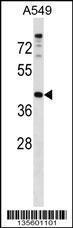 Anti-PAQR7 Rabbit Polyclonal Antibody (Biotin)