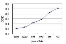 Anti-RNF113B Antibody Pair