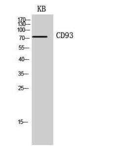 Western blot analysis of KB cells using Anti-CD93 Antibody