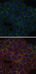 Anti-BLNK Mouse Monoclonal Antibody [clone: 5G9]