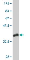 Anti-KLF12 Mouse Monoclonal Antibody [clone: 3D2]