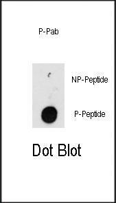 Anti-ILK Rabbit Polyclonal Antibody (Biotin)