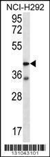 Anti-F2RL2 Rabbit Polyclonal Antibody (APC (Allophycocyanin))