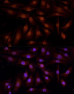 Immunofluorescence analysis of NIH-3T3 using Anti-YAP1 Antibody (A308260) at a dilution of 1:100 (40x lens). DAPI was used to stain the cell nuclei (blue).