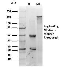 SDS-PAGE analysis of Anti-MED22 Antibody [PCRP-MED22-2A7] under non-reduced and reduced conditions; showing intact IgG and intact heavy and light chains, respectively SDS-PAGE analysis confirms the integrity and purity of the antibody