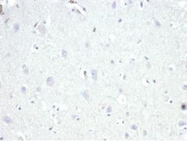 Negative Tissue Control: Immunohistochemical analysis of formalin-fixed, paraffin-embedded human brain using Anti-AMACR Antibody [13H4] at 2µg/ml in PBS for 30 minutes at room temperature