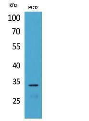 Western blot analysis of extracts from PC12 cells using Anti-CD74 Antibody