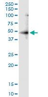 Anti-RNF113B Polyclonal Antibody Pair