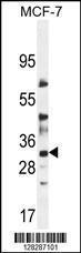 Anti-LYSMD4 Rabbit Polyclonal Antibody (Biotin)