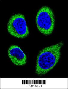 Anti-AGBL5 Rabbit Polyclonal Antibody (AP (Alkaline Phosphatase))