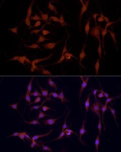 Immunofluorescence analysis of PC-12 using Anti-YAP1 Antibody (A308260) at a dilution of 1:100 (40x lens). DAPI was used to stain the cell nuclei (blue).