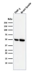 Western blot analysis of THP-1 cell and human brain tissue lysates using Anti-ATG5 Antibody [ATG5/2553]