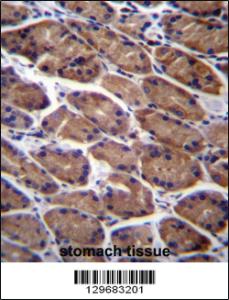 Anti-PODNL1 Rabbit Polyclonal Antibody