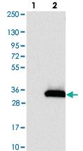 Anti-KCTD14 Rabbit Polyclonal Antibody