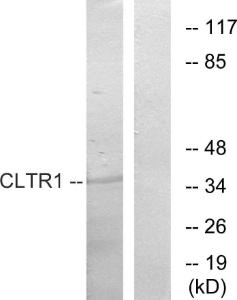 Western blot analysis of lysates from COS7 cells using Anti-CLTR1 Antibody. The right hand lane represents a negative control, where the antibody is blocked by the immunising peptide.