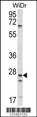 Anti-SCNN1A Rabbit Polyclonal Antibody