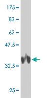 Anti-PI15 Mouse Monoclonal Antibody [clone: 3B5]