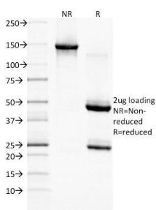 SDS-PAGE analysis of Anti-EGFR Antibody [GFR/1708] under non-reduced and reduced conditions; showing intact IgG and intact heavy and light chains, respectively SDS-PAGE analysis confirms the integrity and purity of the antibody