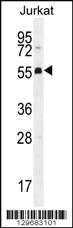 Anti-PODNL1 Rabbit Polyclonal Antibody