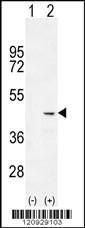 Anti-COCH Rabbit Polyclonal Antibody (HRP (Horseradish Peroxidase))