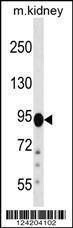 Anti-FIG4 Rabbit Polyclonal Antibody (AP (Alkaline Phosphatase))