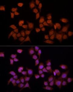 Immunofluorescence analysis of HeLa using Anti-YAP1 Antibody (A308260) at a dilution of 1:100 (40x lens). DAPI was used to stain the cell nuclei (blue).