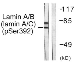 Western blot analysis of lysates from HeLa cells using Anti-Lamin A + C (phospho Ser392) Antibody. The right hand lane represents a negative control, where the antibody is blocked by the immunising peptide.