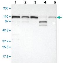 Anti-CTAGE5 Rabbit Polyclonal Antibody