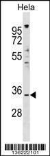 Anti-IMPACT Rabbit Polyclonal Antibody (AP (Alkaline Phosphatase))