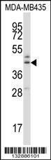 Anti-B3GNT1 Rabbit Polyclonal Antibody