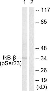 Anti-IKB beta Rabbit Polyclonal Antibody