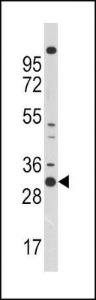 Anti-CDK1 Rabbit Polyclonal Antibody (APC (Allophycocyanin))