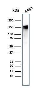 Western blot analysis of A431 cell lysate using Anti-EGFR Antibody [GFR/1708]