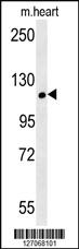 Anti-CRUM2 Rabbit Polyclonal Antibody