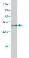 Anti-STYK1 Mouse Monoclonal Antibody [clone: 3A8]