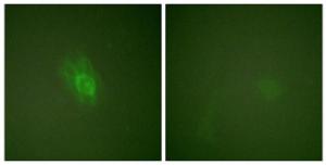 Anti-IKB beta Rabbit Polyclonal Antibody