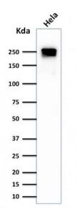 Western blot analysis of HeLa cell lysate using Anti-beta III Spectrin Antibody [SPTBN2/1584]