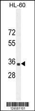 Anti-B3GNT4 Rabbit Polyclonal Antibody (AP (Alkaline Phosphatase))