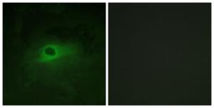 Antibody anti-CSFR 100 µg