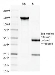 SDS-PAGE analysis of Anti-beta III Spectrin Antibody [SPTBN2/1584] under non-reduced and reduced conditions; showing intact IgG and intact heavy and light chains, respectively. SDS-PAGE analysis confirms the integrity and purity of the antibody.