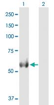 Anti-ALDH4A1 Mouse Polyclonal Antibody