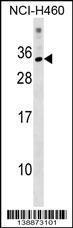 Anti-KRBOX1 Rabbit Polyclonal Antibody (FITC (Fluorescein Isothiocyanate))