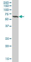 Anti-ALDH4A1 Mouse Polyclonal Antibody