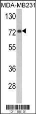 Anti-FMO3 Rabbit polyclonal antibody