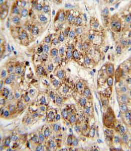 Anti-MCCC2 Rabbit Polyclonal Antibody