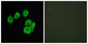 Immunofluorescence analysis of HUVEC cells using Anti-CLTR1 Antibody. The right hand panel represents a negative control, where the antibody was pre-incubated with the immunising peptide.