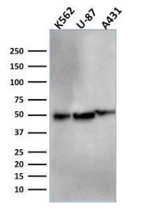 Western blot analysis of K562, U-87, and A431 cell lysates using Anti-ATG5 Antibody [ATG5/2553]