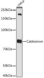 Western blot analysis of extracts of HeLa cells, using Anti-Caldesmon/CDM Antibody [ARC0315] (A308263) at 1:1000 dilution. The secondary Antibody was Goat Anti-Rabbit IgG H&L Antibody (HRP) at 1:10000 dilution. Lysates/proteins were present at 25 µg per lane