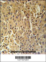 Anti-MGMT Rabbit Polyclonal Antibody